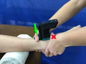 Posterior Glide with the Mobil-Aider