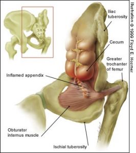 Obturaor-Appendix Anatomy