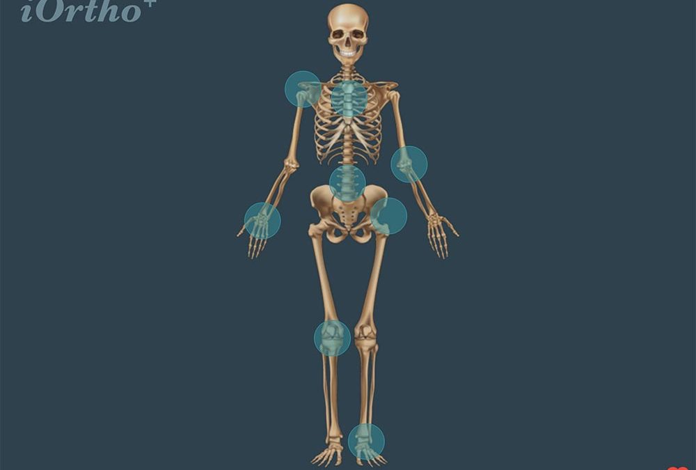 iOrtho Skeleton image