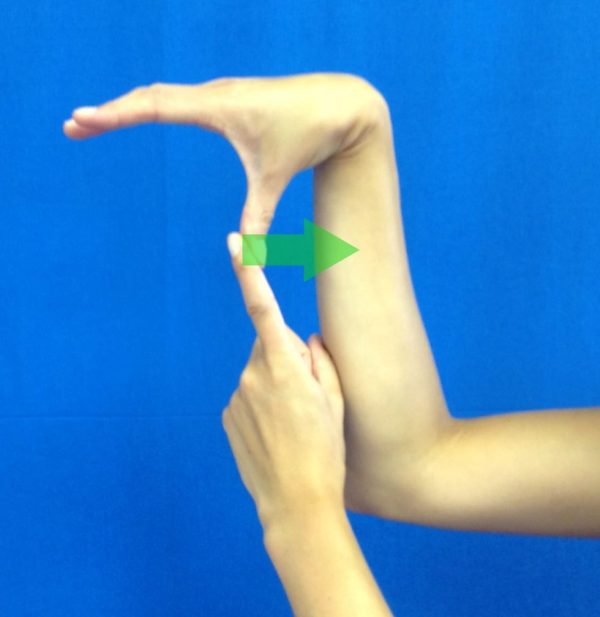 No, You Are Not "Double Jointed" iOrtho+®